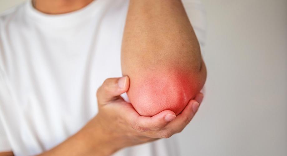 cbd pain relief cream